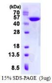 Human Creatine kinase MT 1A protein, His tag (active). GTX66950-pro
