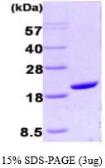Human Cyclophilin A protein, His tag (active). GTX66954-pro