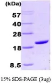 Human Cyclophilin A protein, His tag (active). GTX66954-pro