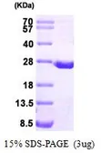 Human DHFR protein, His tag (active). GTX66969-pro