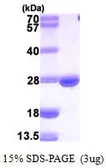 mouse DHFR protein, His tag (active). GTX66970-pro