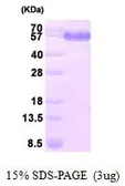 Human DLD protein, His tag (active). GTX66971-pro
