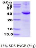 Human DUSP10 protein, His tag (active). GTX66973-pro