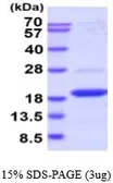 Human DUSP23 protein, His tag (active). GTX66974-pro
