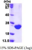 Human DUSP3 protein, His tag (active). GTX66975-pro