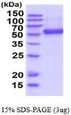 Human ENTPD3 protein, His tag (active). GTX66982-pro