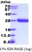 Human EPO protein, His tag (active). GTX66983-pro