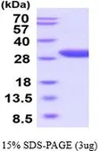 Human EPO receptor protein, His tag (active). GTX66984-pro