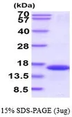 Human FKBP1B protein, His tag (active). GTX66992-pro