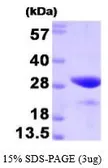 Human FKBP25 protein (active). GTX66994-pro