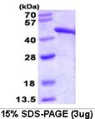 Human Fumarate hydratase protein (active). GTX66998-pro