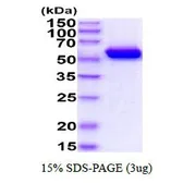 Human G6PD protein, His tag (active). GTX66999-pro