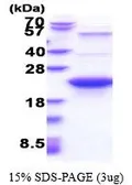 Human Glyoxalase I protein, His tag (active). GTX67014-pro