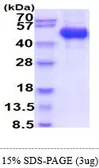 Human GM-CSF Receptor alpha protein, His tag (active). GTX67018-pro