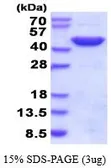 Human GOT2 protein, His tag (active). GTX67022-pro