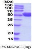 Human GPT protein, His tag (active). GTX67024-pro
