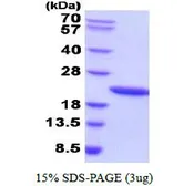 Human Growth Hormone protein (active). GTX67029-pro