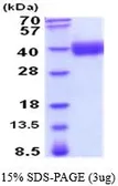 Human Growth hormone Receptor protein, His tag (active). GTX67031-pro