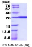 Human GSTA4 protein, His tag (active). GTX67034-pro
