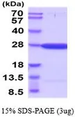 Human Guanylate kinase protein, His tag (active). GTX67045-pro