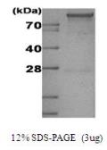 Human Hexokinase 1 protein, His tag (active). GTX67047-pro