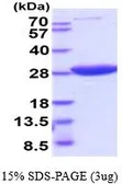Human HPRT protein, His tag (active). GTX67051-pro