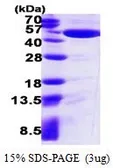 Human IDH1 protein, His tag (active). GTX67054-pro