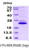 Mouse IL1 beta protein, His tag (active). GTX67058-pro