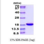 Human IL33 protein. GTX67064-pro