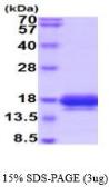 Human IL5 protein, His tag (active). GTX67068-pro