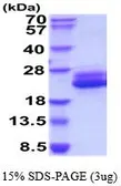 Human IL6 protein, His tag (active). GTX67071-pro