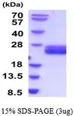 Mouse IL6 protein, His tag (active). GTX67072-pro