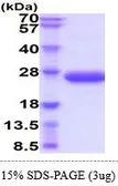 Rat IL6 protein, His tag (active). GTX67073-pro