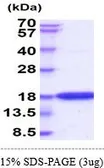 Human Interferon gamma protein, His tag (active). GTX67079-pro