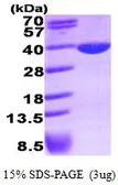 Human LDHA protein, His tag (active). GTX67081-pro