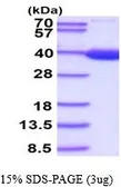 Human LDH-B protein, His tag (active). GTX67084-pro