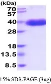 Human M-CSF protein, His tag (active). GTX67088-pro