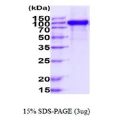 Human M-CSF Receptor protein, human IgG1 Fc and His tag (active). GTX67089-pro
