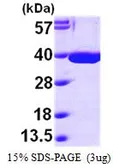 Human MDH2 protein, His tag (active). GTX67091-pro