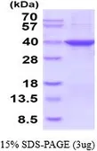 Human Monoglyceride lipase protein, His tag (active). GTX67093-pro