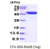 Human PAI-1 protein, His tag (active). GTX67102-pro