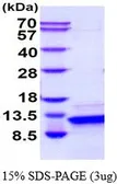 Human Parathyroid Hormone protein (active). GTX67104-pro
