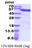 Human PDIA6 protein, His tag (active). GTX67107-pro