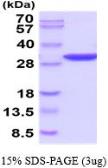 Human PGAM2 protein, His tag (active). GTX67112-pro