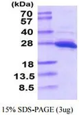 Human PGP9.5 protein (active). GTX67118-pro