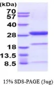 Mouse PGP9.5 protein, His tag (active). GTX67119-pro