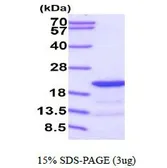 Human PIN4 protein, His tag (active). GTX67123-pro