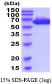 Human Placental Alkaline Phosphatase protein, His tag (active). GTX67126-pro
