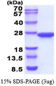 Human Prolactin protein (active). GTX67139-pro