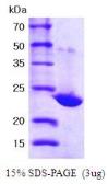 Human PRX I protein, His tag (active). GTX67142-pro